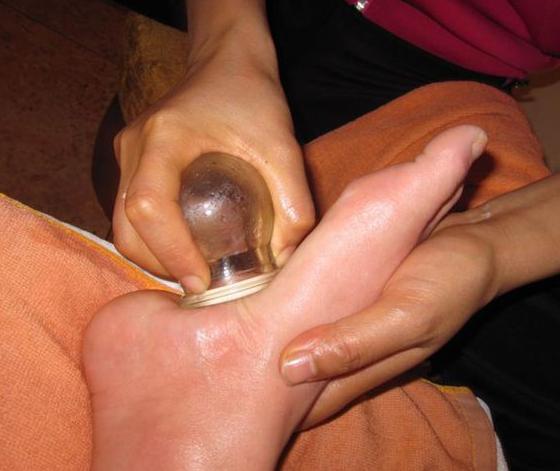 拔火罐對腎虛有好處嗎?深度解析傳統(tǒng)療法與現(xiàn)代健康理念,拔火罐對腎虛的益處解析,傳統(tǒng)療法與現(xiàn)代健康理念融合探索
