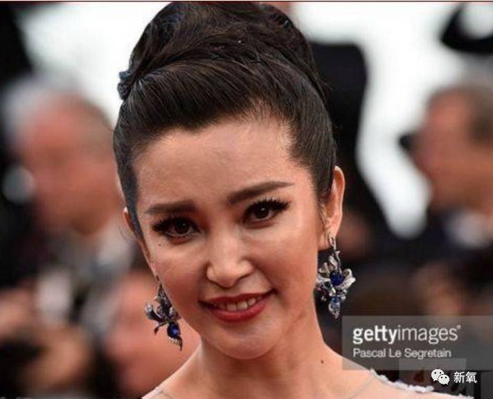 激光去眼袋能維持幾年，全面解析與你的期望相匹配，激光去眼袋效果能維持多久？全面解析滿足你的期望