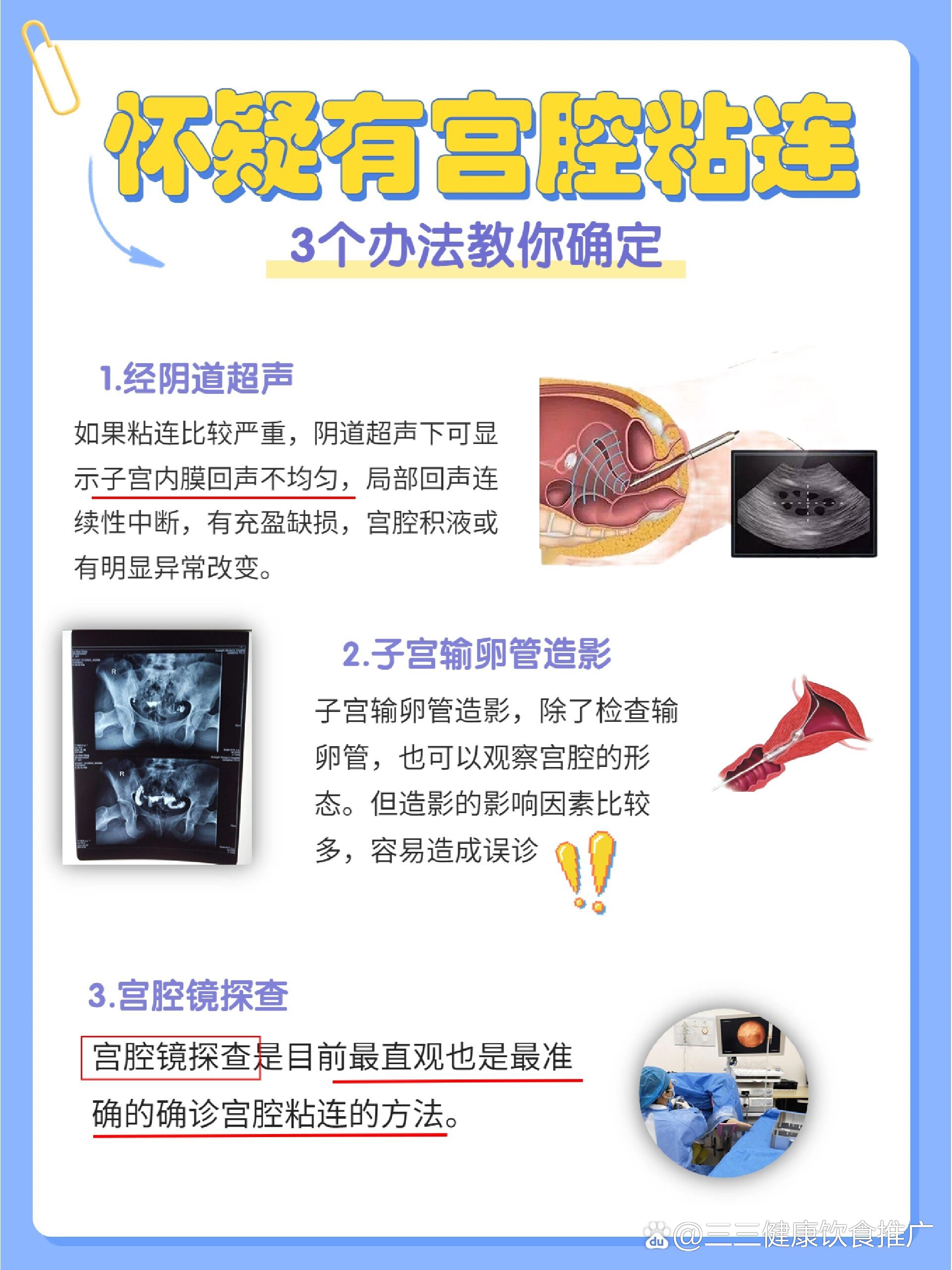 宮腔粘連自檢方法及其重要性，宮腔粘連自檢方法及其重要性解析