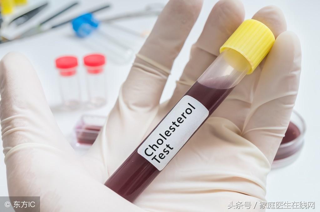 糖尿病的成因，深度解析其背后的原因，深度解析糖尿病成因，揭示背后原因真相