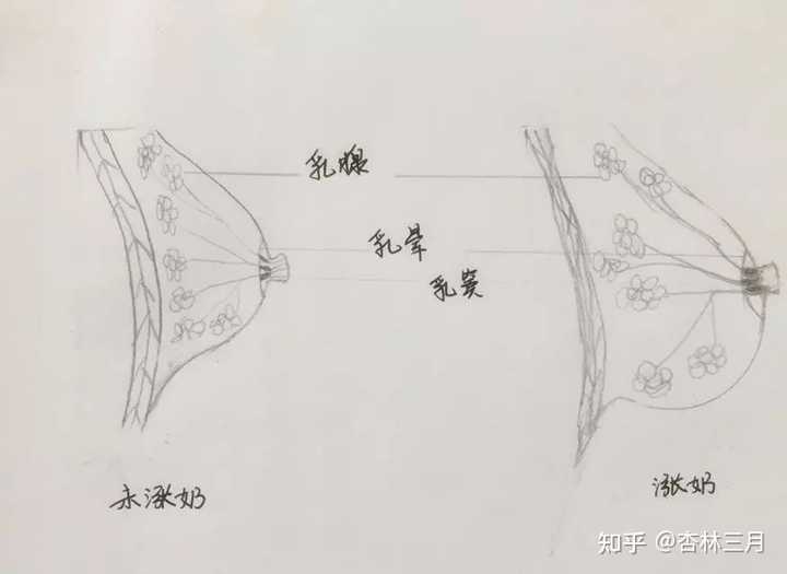 乳房硬塊消除，了解成因與應(yīng)對方法，乳房硬塊消除，成因解析與應(yīng)對方法指南