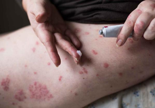 鼻咽癌前期的18種預兆及其重要性，鼻咽癌前期的18種預兆與重要性解析