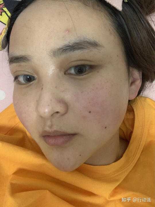 敏感肌膚修復(fù)指南,如何恢復(fù)健康正常肌膚,敏感肌膚修復(fù)全攻略,重塑健康肌膚的秘訣