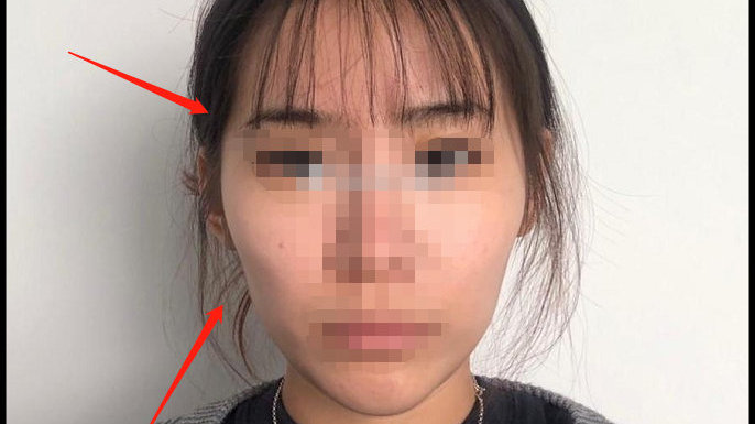 顴骨突出臉型圖,解析臉型特點與修飾技巧,顴骨突出臉型解析及修飾技巧圖解