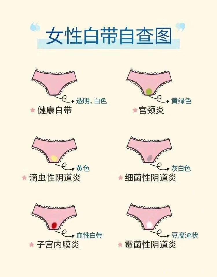 關于白帶,了解、關注與呵護女性健康的重要一環,女性健康的關鍵,了解、關注與呵護白帶的重要性