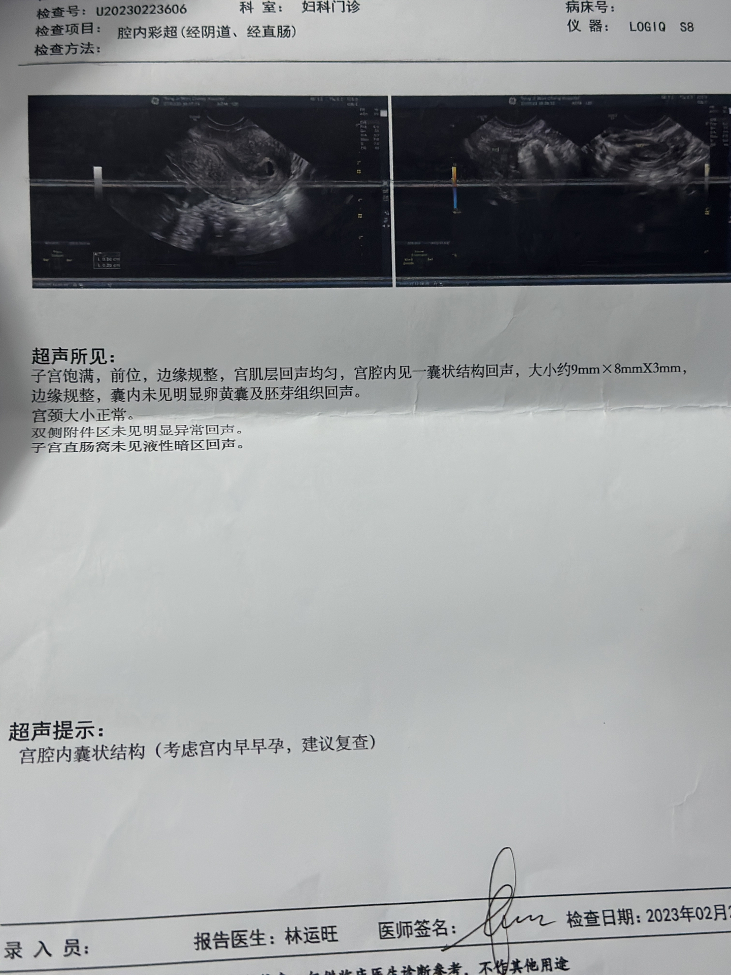 胎停誤診現(xiàn)象頻發(fā),我們需要深入了解與防范,胎停誤診頻發(fā),深入了解與防范的重要性