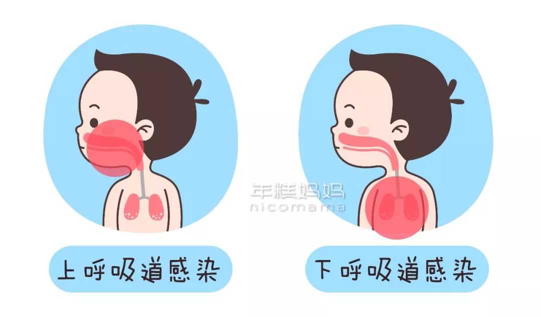肺炎與普通咳嗽的區別,深入了解癥狀、起因及應對方法,肺炎與普通咳嗽的區別詳解,癥狀、起因和應對方法指南