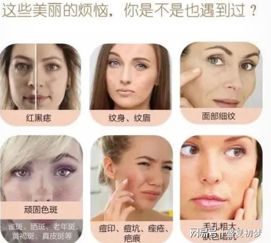 激光祛斑真害人?深度解析激光祛斑的利與弊,深度解析,激光祛斑的利弊與潛在風險揭秘