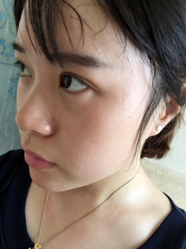 上眼皮抽脂手術,前后圖片對比與深度解析,上眼皮抽脂手術,前后對比與深度解析