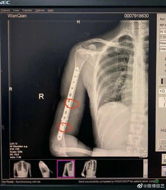 萬茜個人資料簡介及,一位多才多藝的耀眼明星,萬茜,多才多藝的耀眼明星個人資料簡介