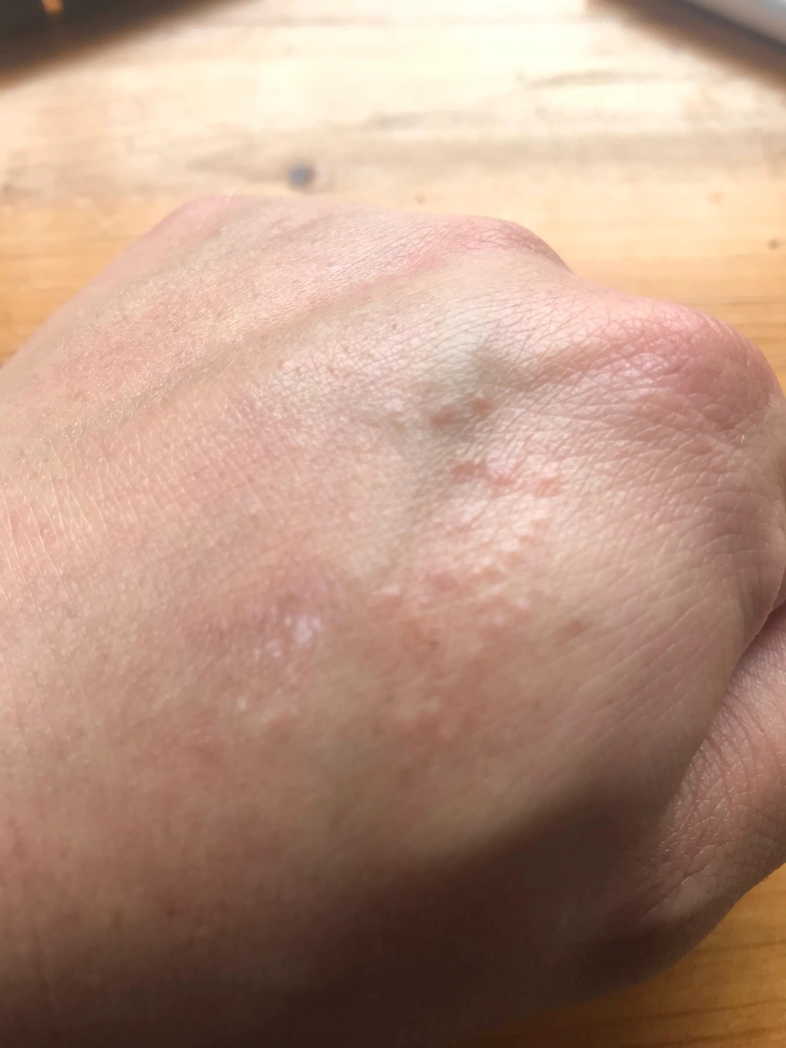 無緣無故長疙瘩又紅又癢,原因解析與應對策略,無緣無故長紅癢疙瘩,原因解析及應對方法