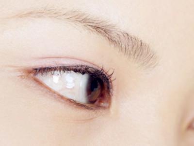如何有效去除眼睛魚尾紋——全方位指南,全方位指南,如何有效去除眼睛魚尾紋