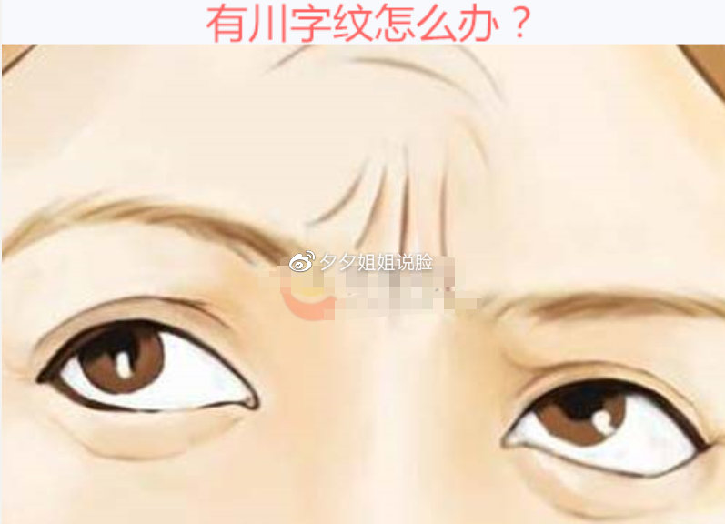 川字紋消除小偏方——讓你輕松告別皺紋困擾,川字紋消除偏方,告別皺紋,輕松展現年輕光彩!