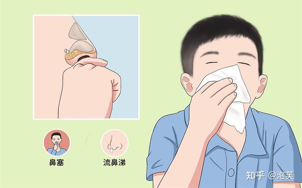 鼻塞快速通氣小妙招,實(shí)用方法助你迅速緩解不適,鼻塞快速通氣小妙招,實(shí)用方法讓你迅速告別不適