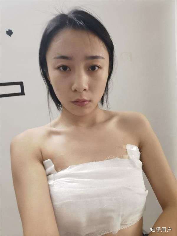 隆胸五年的感受,我的親身經(jīng)歷與體驗分享,隆胸五年的真實感受,我的親身經(jīng)歷與深度體驗分享