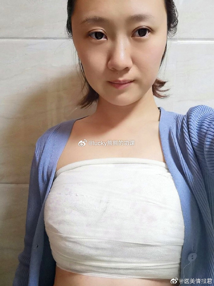 隆胸五年的感受,我的親身經(jīng)歷與體驗分享,隆胸五年的真實感受,我的親身經(jīng)歷與深度體驗分享