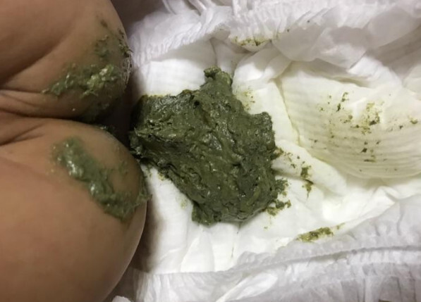 寶寶正常綠色大便圖片,了解嬰兒健康排便狀態(tài)的重要性,嬰兒健康排便指南,識別寶寶正常綠色大便的重要性圖片分享