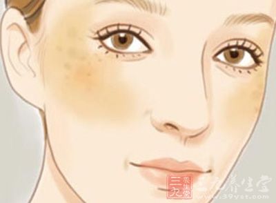 怎樣祛除黃褐斑最有效的方法,最有效的黃褐斑祛除方法