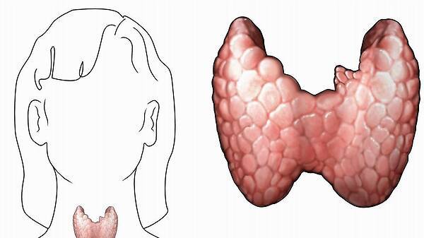 甲狀腺結(jié)節(jié)三吃三不吃,飲食調(diào)整與生活方式優(yōu)化,甲狀腺結(jié)節(jié)的飲食調(diào)整與生活方式優(yōu)化,三吃三不吃指南