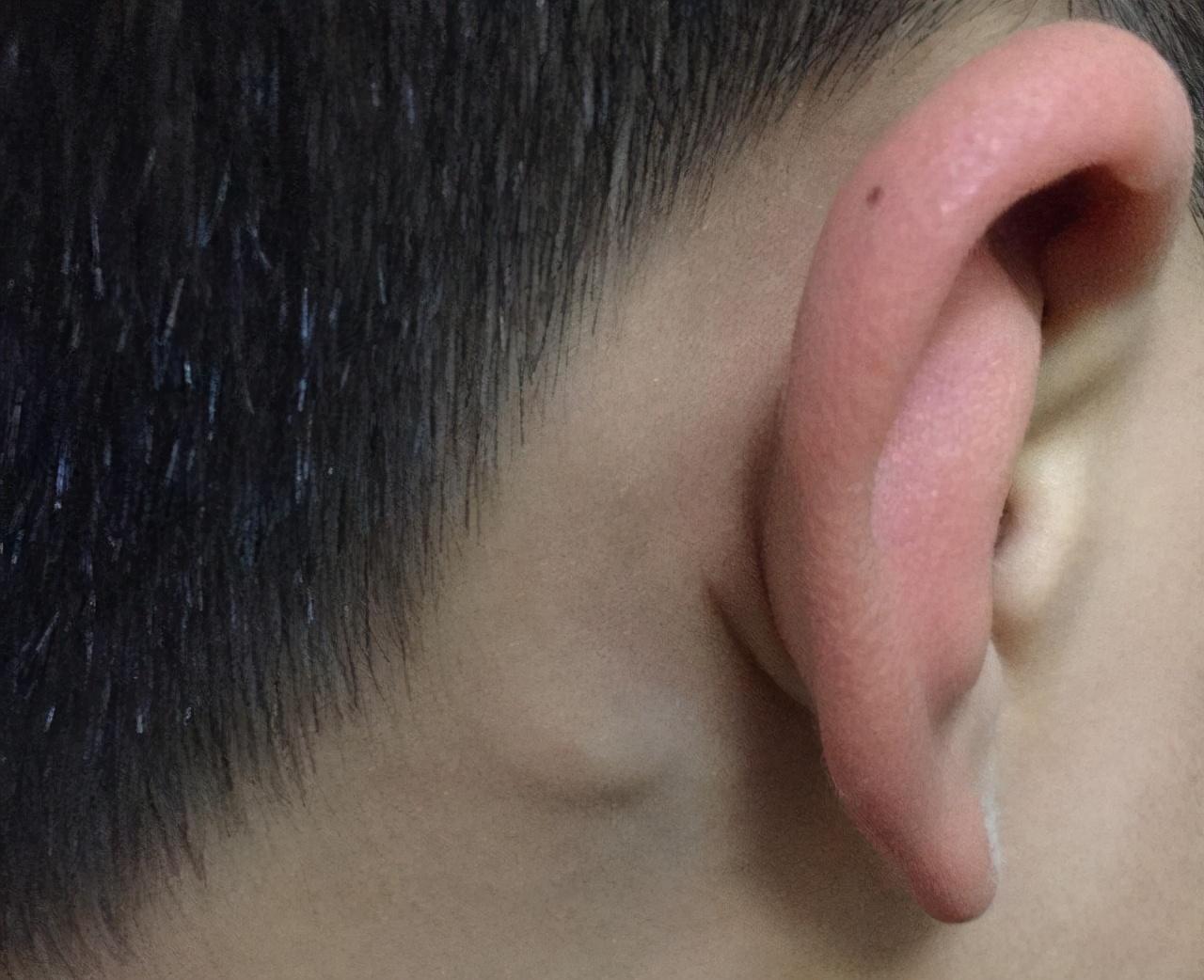 耳朵里面疼是怎么回事,深度解析與應對建議,耳朵內部疼痛原因深度解析及應對建議