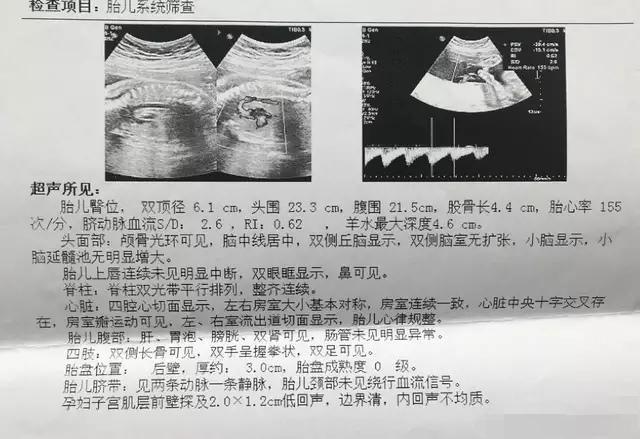 殲-11B重型戰(zhàn)斗機，卓越性能與先進技術(shù)的完美結(jié)合，殲-11B重型戰(zhàn)斗機，卓越性能與技術(shù)的巔峰融合