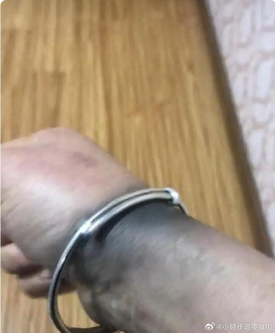 手銀過度早迣,藥物治療與效果解析,手銀過度導致的早迣,藥物治療與效果解析