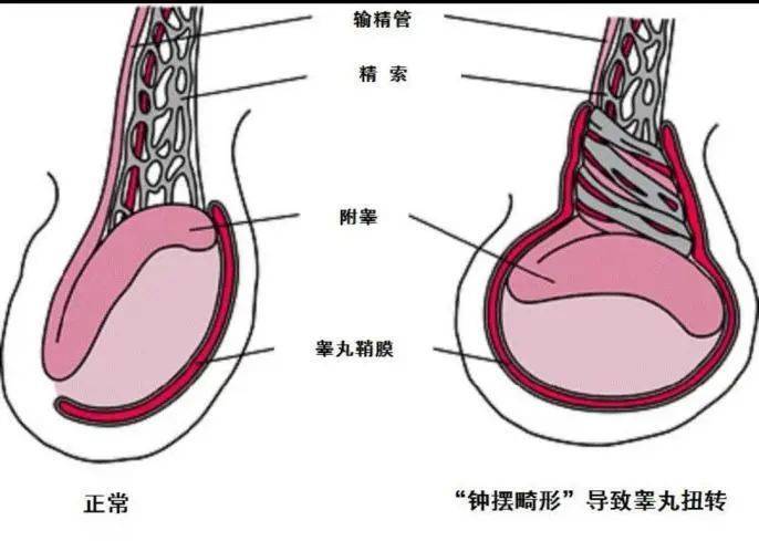 飛機打多了睪丸變小能恢復嗎?——探究原因與恢復可能性,飛機打多了睪丸變小能否恢復,原因與恢復可能性探討