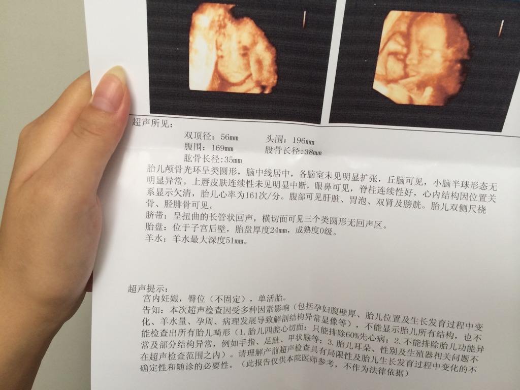 四維彩超下的睪丸,探索與理解,四維彩超下的睪丸,深入探索與理解