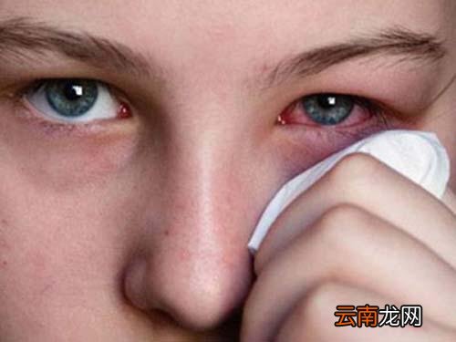 紅眼病30秒神奇治愈方法,揭秘快速恢復(fù)秘籍,紅眼病快速治愈秘籍,30秒神奇恢復(fù)方法揭秘