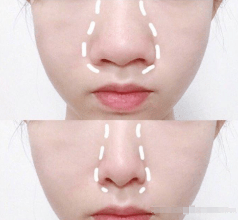 不動手術縮小鼻頭,自然方法與實用技巧,自然縮小鼻頭的方法與實用技巧分享