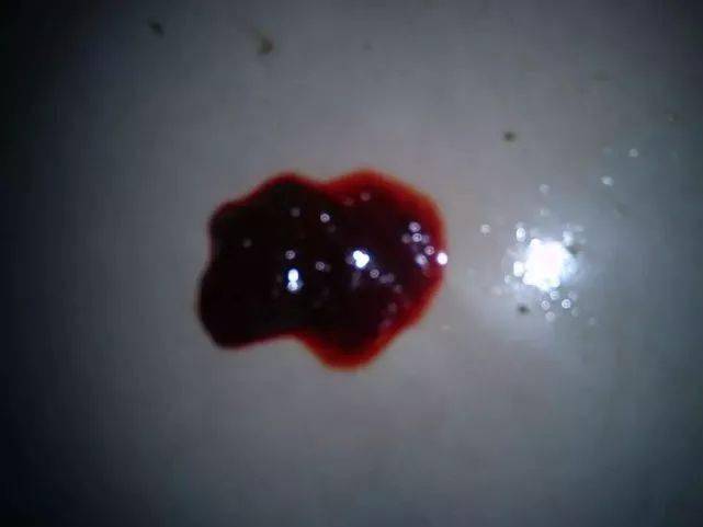 排便時出現撕裂感及出血，原因與應對措施，排便疼痛撕裂感及出血，原因分析及應對方法