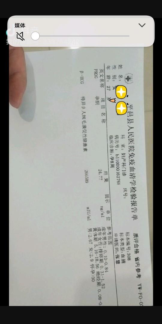 HCG值下降,解讀其意義與影響,HCG值下降,意義與影響解讀