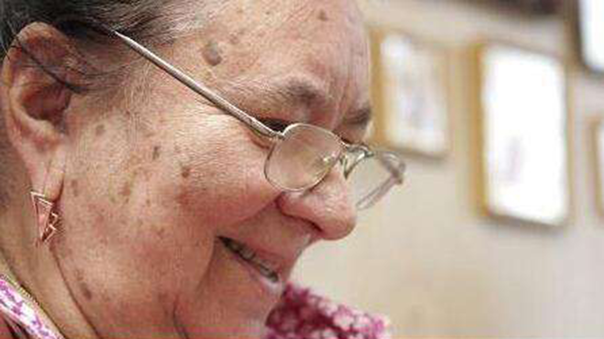 老年斑的形成原因及消除方法,老年斑的形成原因與消除方法全解析