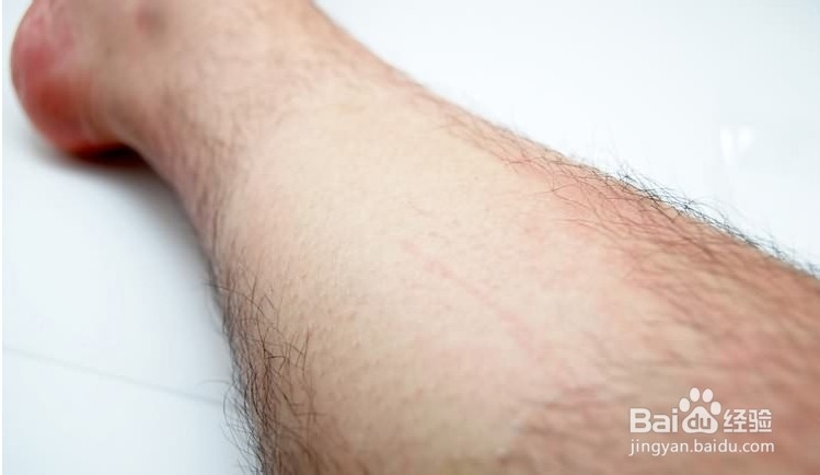 如何讓汗毛自然脫落,探索自然去毛的方法,自然去毛方法探索,助力汗毛自然脫落之道