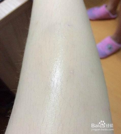 如何讓汗毛自然脫落,探索自然去毛的方法,自然去毛方法探索,助力汗毛自然脫落之道