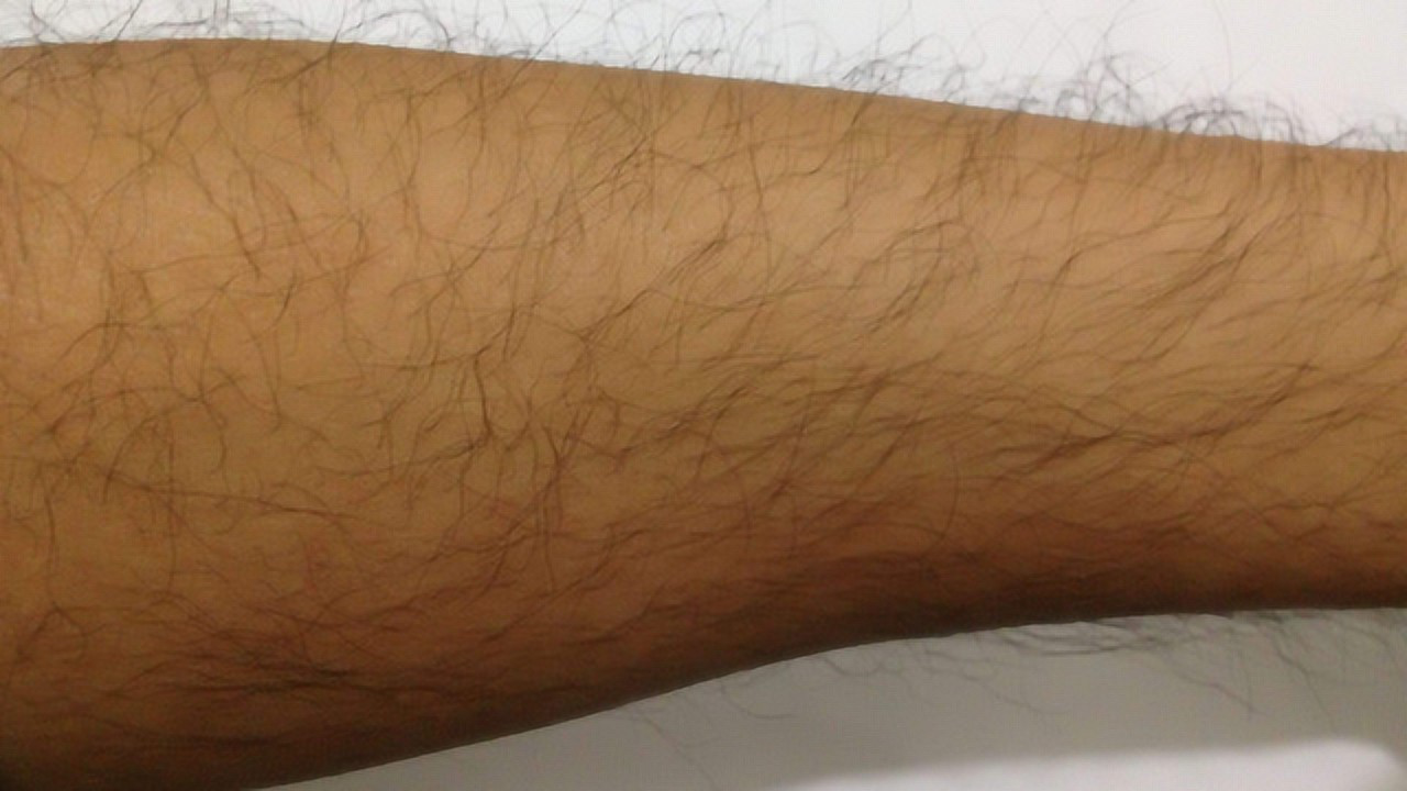 如何讓汗毛自然脫落,探索自然去毛的方法,自然去毛方法探索,助力汗毛自然脫落之道