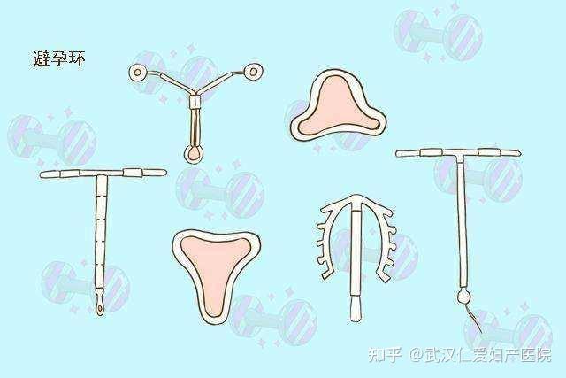 上環后同房過猛會移位嗎?深入了解與注意事項,上環后同房注意事項,過猛行為可能導致移位風險探討