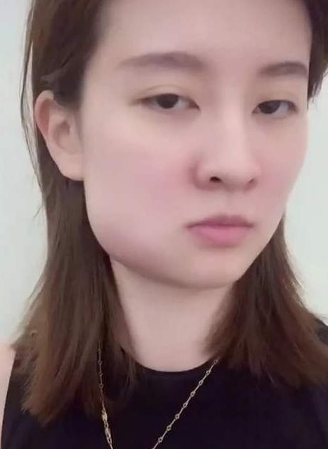 拔智齒多少錢一顆?一文解讀智齒拔除費用(2022年),2022年智齒拔除費用詳解,拔智齒多少錢一顆?一文解讀智齒拔除費用問題。