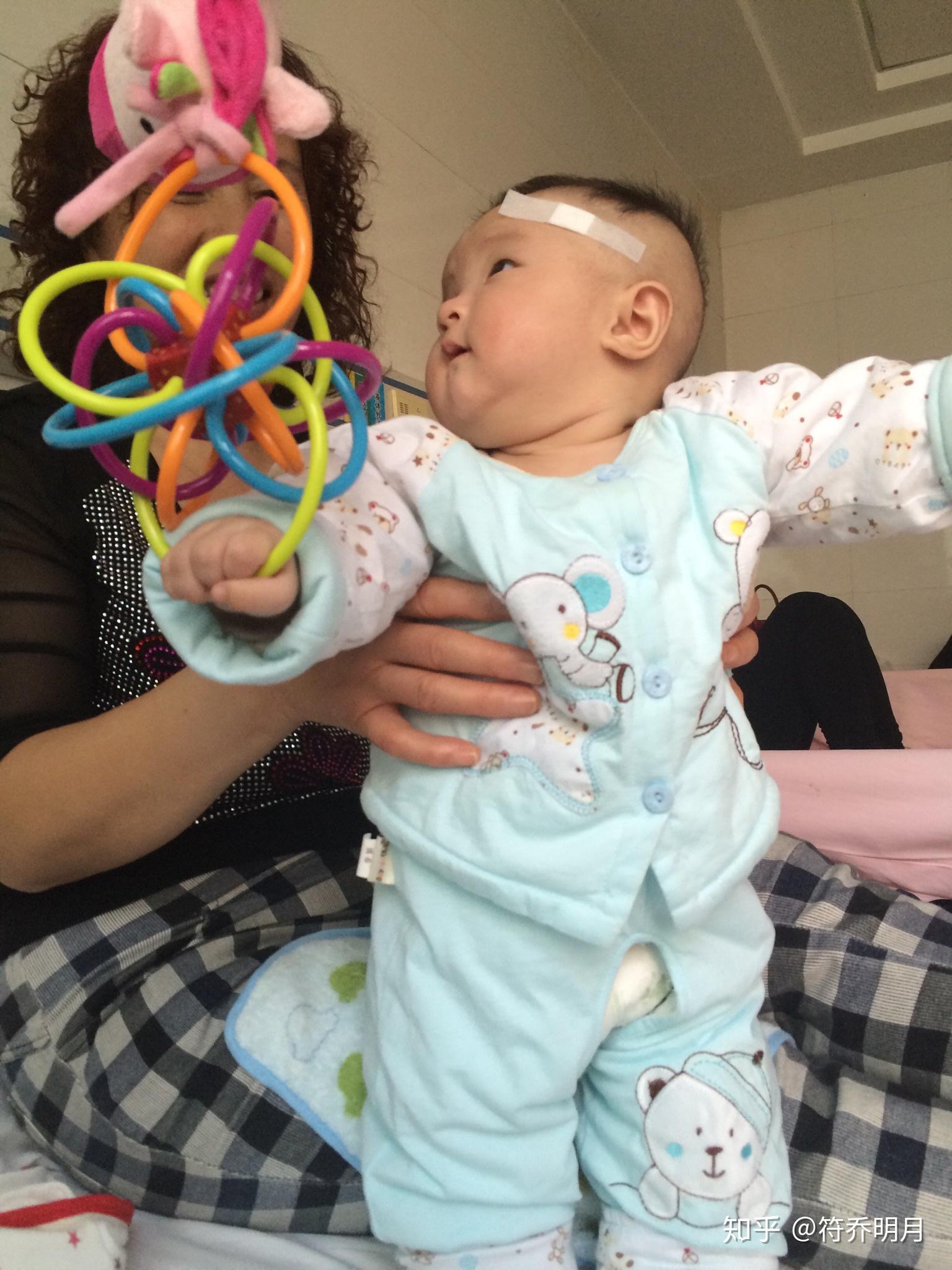 二個月嬰兒腦癱最明顯的特征，二個月嬰兒腦癱最明顯的特征表現