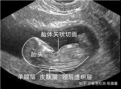 深入了解NT結果,解析與應用,深入了解NT結果解析與應用指南