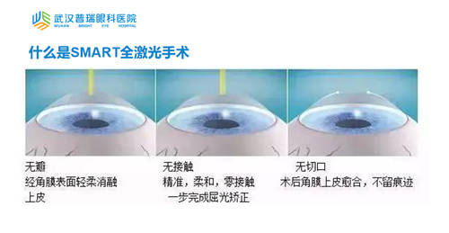 晶體植入近視手術的利與弊，全面解析與深度探討，晶體植入近視手術的利與弊，全面解析與深度探討深度探討及解析近視手術晶體植入利弊