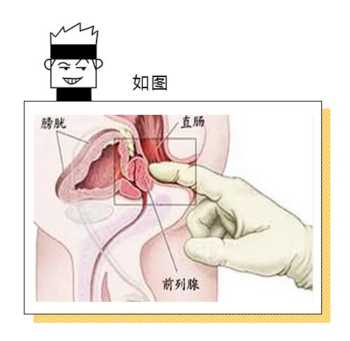 前列腺按摩手法與位置指南，全面解析與實踐，前列腺按摩手法與位置指南，全面解析與實踐技巧