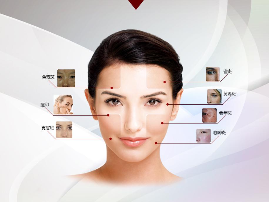 激光祛斑，一次能否徹底去除斑點？，激光祛斑能否一次徹底去除斑點？