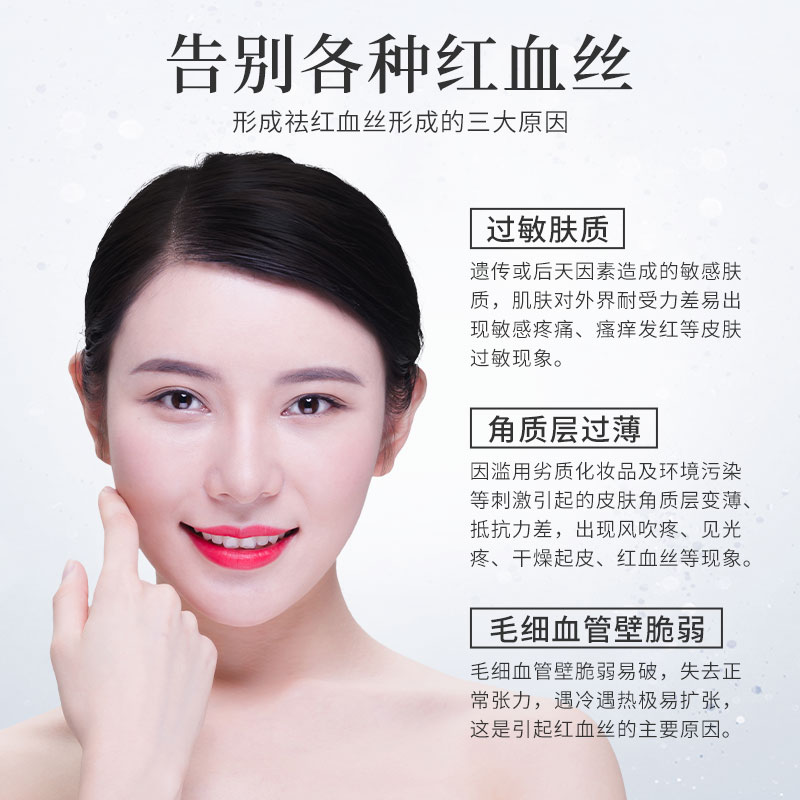 紅血絲的克星是什么，終極解決方案助你擺脫困擾，紅血絲終極解決方案，擺脫困擾的克星揭秘