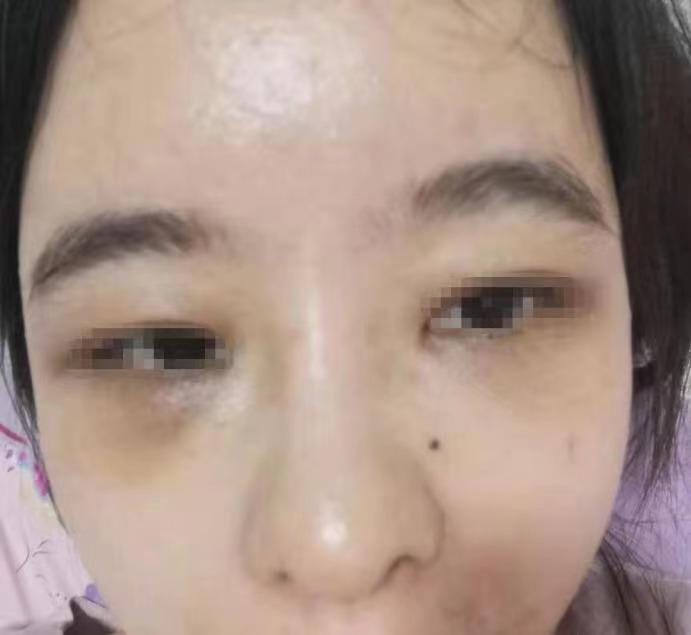 鼻整形，探索最佳實踐，實現(xiàn)美麗與自信的完美融合，鼻整形，最佳實踐探索，美麗與自信的和諧融合