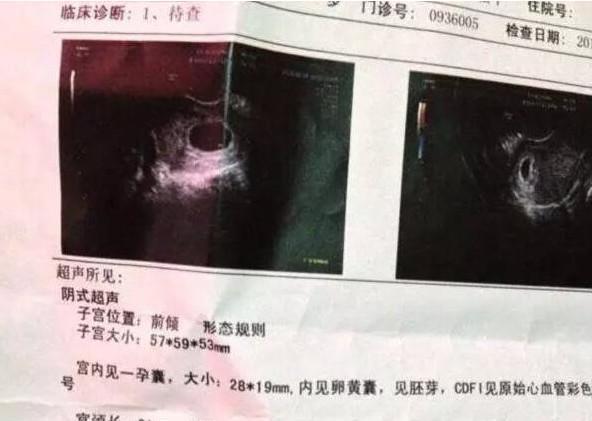 懷孕三個月自測男女，了解胎兒性別預測方法及注意事項，懷孕三個月胎兒性別預測方法及注意事項，自測男女須知