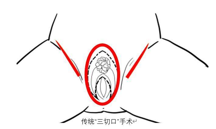 正常陰脣圖片，了解、識(shí)別與重要性，正常陰脣圖片，了解、識(shí)別及其重要性