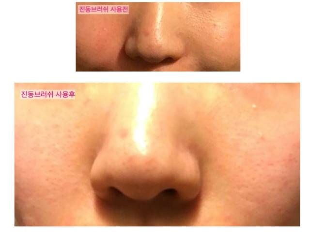 激光美白，讓你膚色煥新，白幾個度不再是夢，激光美白，重塑膚色，白皙煥新不再是夢