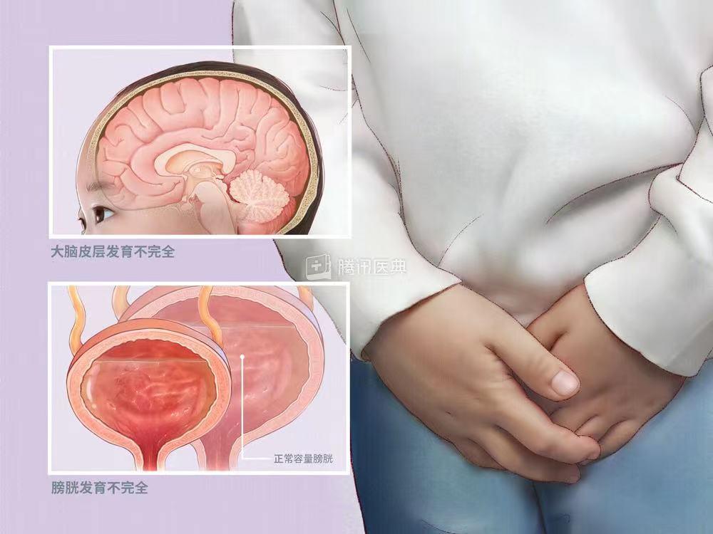 龜頭炎的癥狀表現及其影響，龜頭炎的癥狀表現及其影響分析