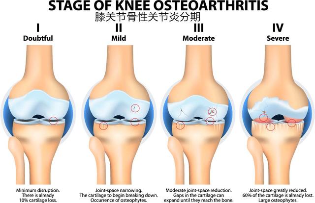 膝關(guān)節(jié)疼痛的十大原因及其應(yīng)對方法,膝關(guān)節(jié)疼痛的成因與應(yīng)對方法解析,十大常見原因及應(yīng)對策略